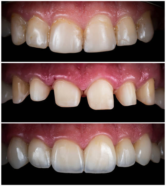 sedation-dentistry